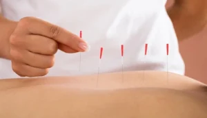 Why Is Dry Needling Illegal?